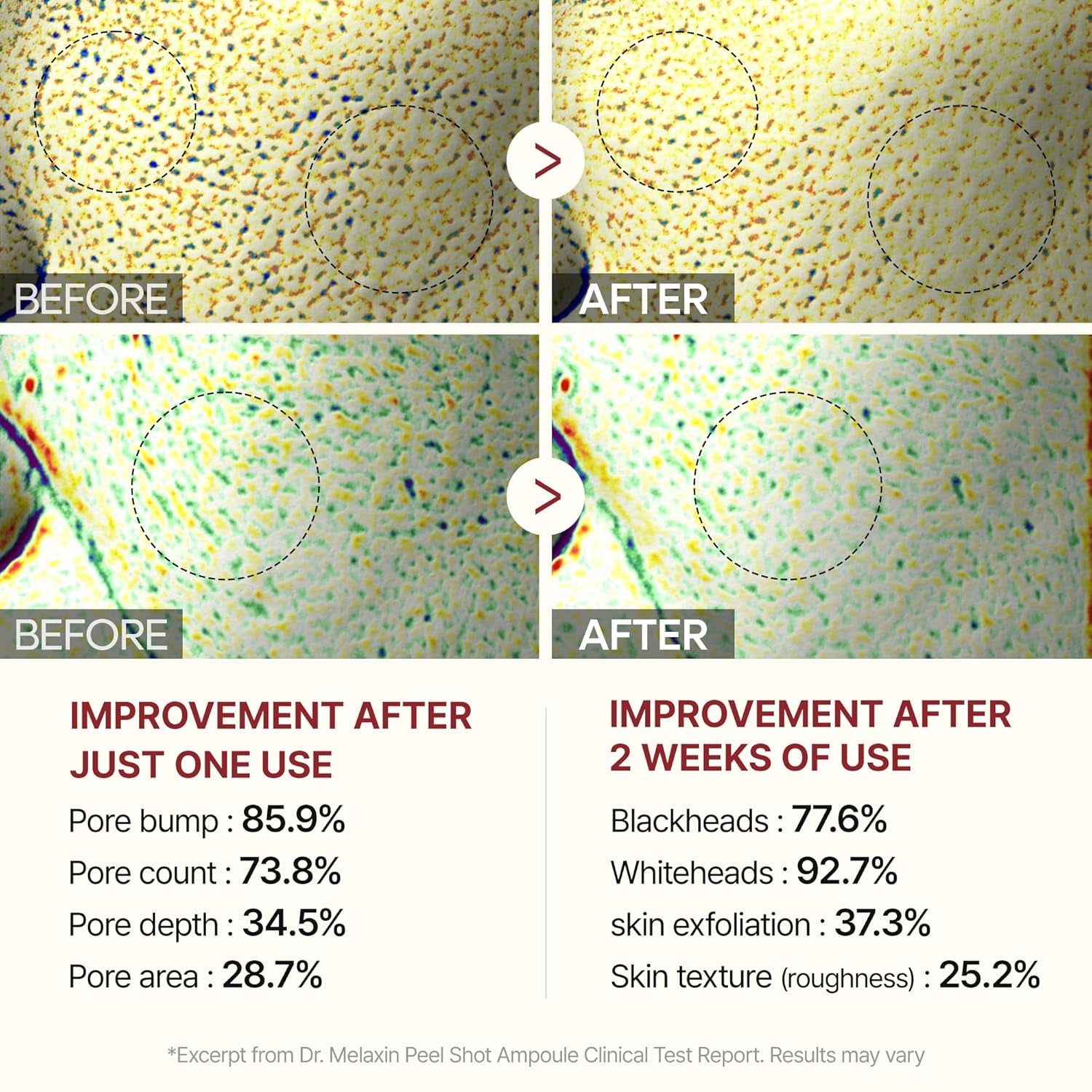 Peel Shot Glow White Rice Peeling Ampoule, Soft Exfoliating Face and Body Scrub Dead Skin Cells Remover for All Skin Types Korean Skin Care 80Ml